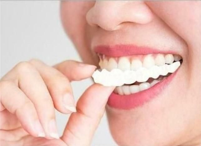 Instant Snap-On Smile Clip-On Veneers | Temporary Teeth Braces Cover for Perfect White Smile