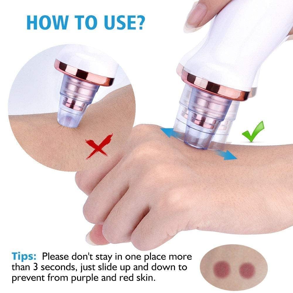 6-in-1 Multi-Function Blackhead Remover Vacuum | Electric Pore Cleaner & Dermasuction Tool | USB Rechargeable Facial Pore Extractor for All Skin Types