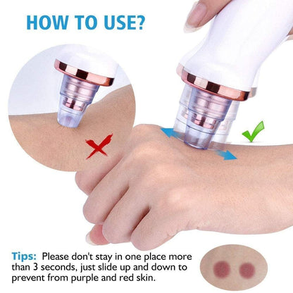 6-in-1 Multi-Function Blackhead Remover Vacuum | Electric Pore Cleaner & Dermasuction Tool | USB Rechargeable Facial Pore Extractor for All Skin Types