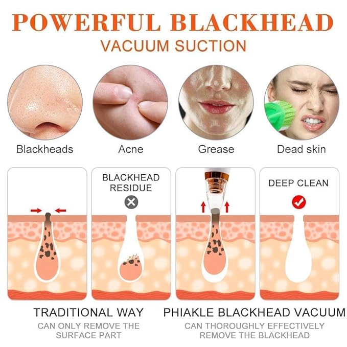 6-in-1 Multi-Function Blackhead Remover Vacuum | Electric Pore Cleaner & Dermasuction Tool | USB Rechargeable Facial Pore Extractor for All Skin Types