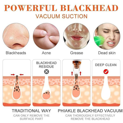 6-in-1 Multi-Function Blackhead Remover Vacuum | Electric Pore Cleaner & Dermasuction Tool | USB Rechargeable Facial Pore Extractor for All Skin Types