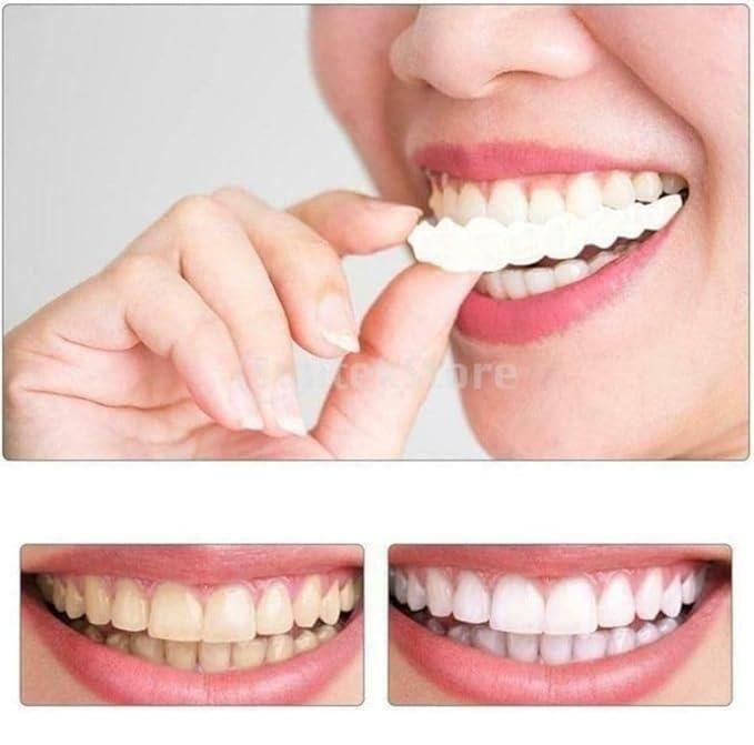 Instant Snap-On Smile Clip-On Veneers | Temporary Teeth Braces Cover for Perfect White Smile