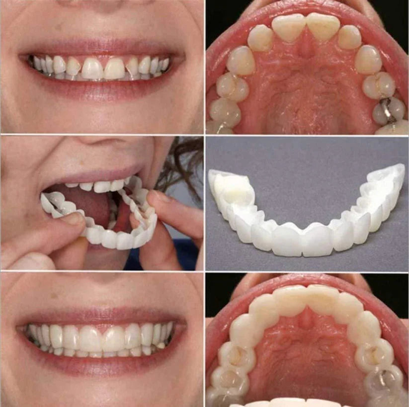 Instant Snap-On Smile Clip-On Veneers | Temporary Teeth Braces Cover for Perfect White Smile